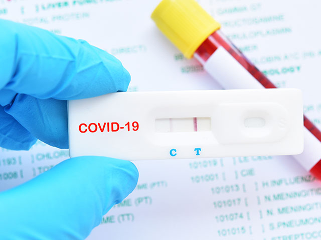 新型コロナウイルス感染症（COVID-19）の正しい予防対策